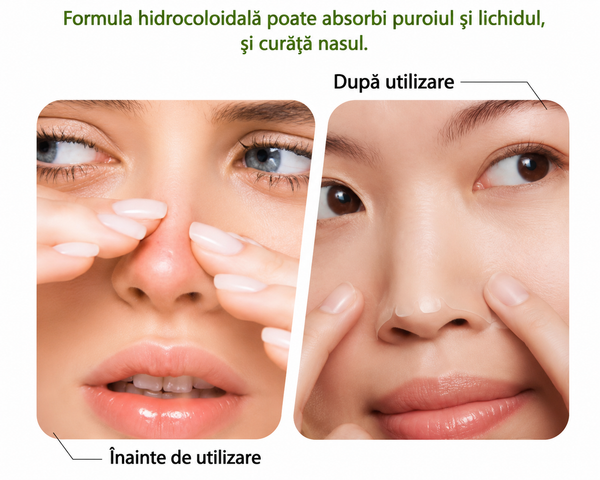 Benzi Purificatoare pentru Nas și Sebum Control cu Tehnologie Hydrocolloid (set de 4 bucati)